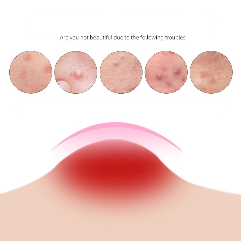 Parche de Acné de Dibujos Anim - Beauty Of Makeup reseña y precio